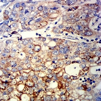 Cyclin D1 Mouse Monoclonal Antibody