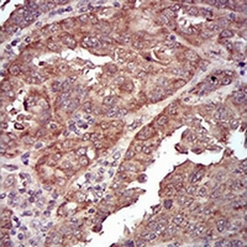 Caveolin 2 Mouse Monoclonal Antibody