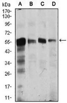 CaMK4 Mouse Monoclonal Antibody