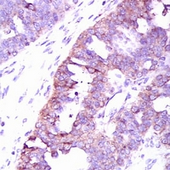 CaMK4 Mouse Monoclonal Antibody