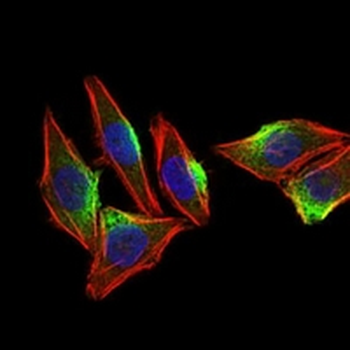 CaMK4 Mouse Monoclonal Antibody