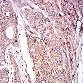 CaMK2 gamma Mouse Monoclonal Antibody