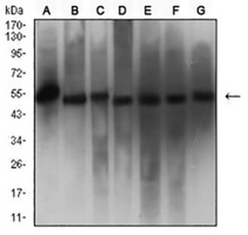 Calreticulin Mouse Monoclonal Antibody