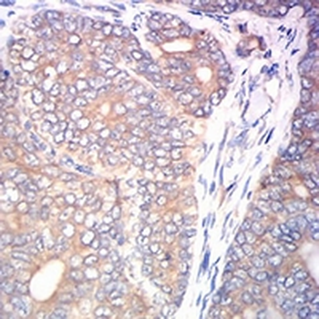 Calreticulin Mouse Monoclonal Antibody