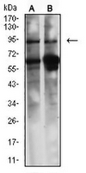 Caldesmon Mouse Monoclonal Antibody