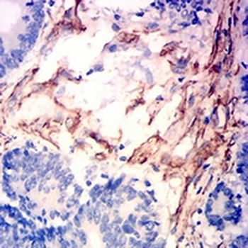 Caldesmon Mouse Monoclonal Antibody