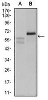 Carbonic Anhydrase 9 Mouse Monoclonal Antibody