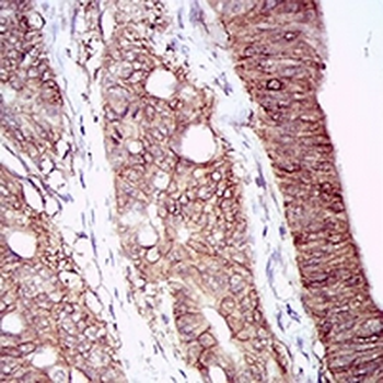 Carbonic Anhydrase 9 Mouse Monoclonal Antibody
