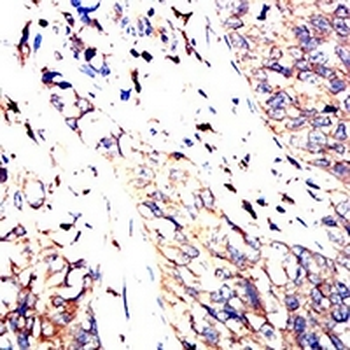C9orf72 Mouse Monoclonal Antibody