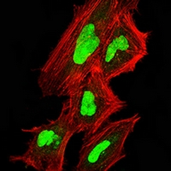C9orf72 Mouse Monoclonal Antibody