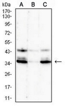 GPR77 Mouse Monoclonal Antibody