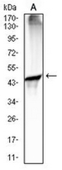 CD88 Mouse Monoclonal Antibody