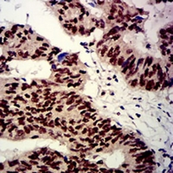 beta-TrCP Mouse Monoclonal Antibody