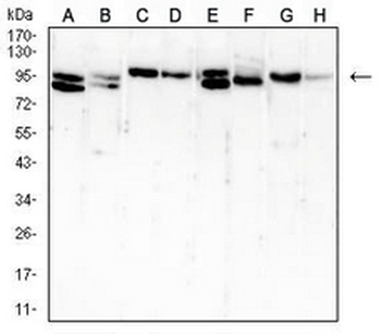 B-RAF Mouse Monoclonal Antibody