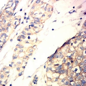 B-RAF Mouse Monoclonal Antibody