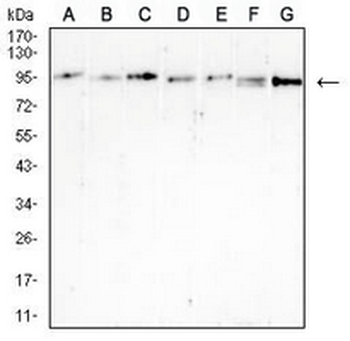 B-RAF Mouse Monoclonal Antibody