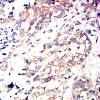 B-RAF Mouse Monoclonal Antibody