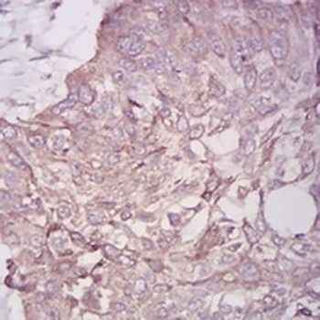 BMP7 Mouse Monoclonal Antibody