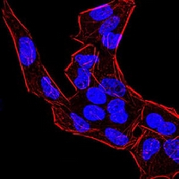 BMP4 Mouse Monoclonal Antibody
