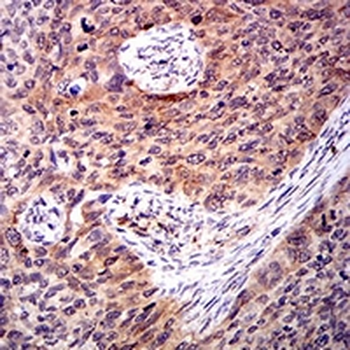 Amphiphysin 2 Mouse Monoclonal Antibody