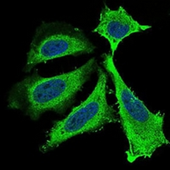 BDNF Mouse Monoclonal Antibody