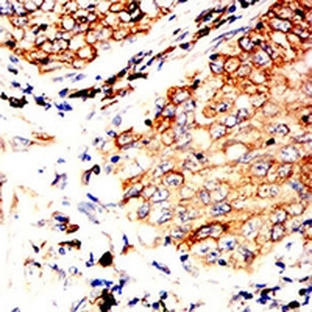BCL6 Mouse Monoclonal Antibody