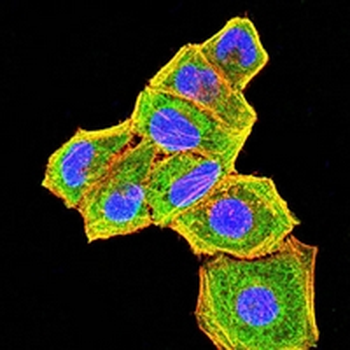 BCL6 Mouse Monoclonal Antibody