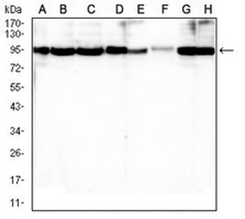 BCL2 Mouse Monoclonal Antibody