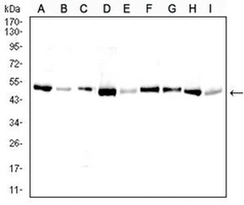 BAX Mouse Monoclonal Antibody