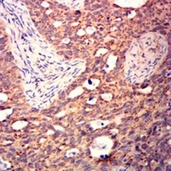 BAX Mouse Monoclonal Antibody