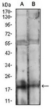 BAD Mouse Monoclonal Antibody