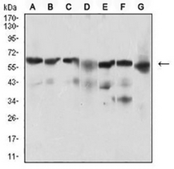 BACE1 Mouse Monoclonal Antibody