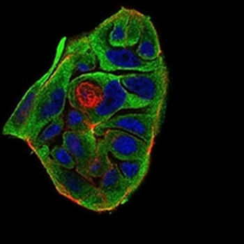 BACE1 Mouse Monoclonal Antibody