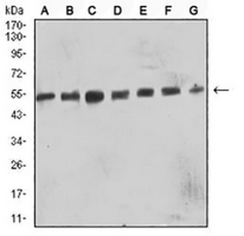 CD57 Mouse Monoclonal Antibody
