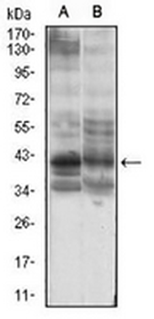 B3GALT4 Mouse Monoclonal Antibody