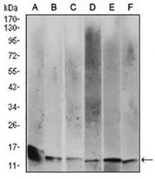 Beta 2 Microglobulin Mouse Monoclonal Antibody