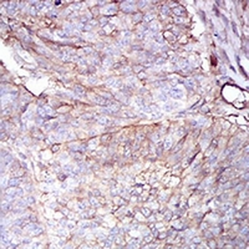 Beta 2 Microglobulin Mouse Monoclonal Antibody
