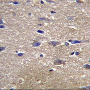 Aurora A Mouse Monoclonal Antibody