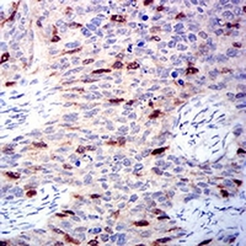 Aurora A Mouse Monoclonal Antibody