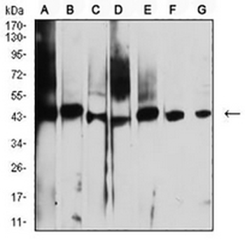 AUP1 Mouse Monoclonal Antibody
