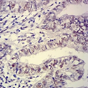 Ataxin 1 Mouse Monoclonal Antibody