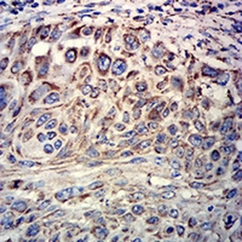 ATP5A1 Mouse Monoclonal Antibody