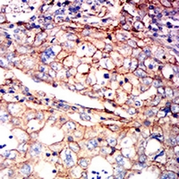 ATP1A1 Mouse Monoclonal Antibody