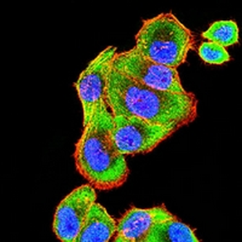 ATP1A1 Mouse Monoclonal Antibody