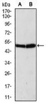 ATG5 Mouse Monoclonal Antibody