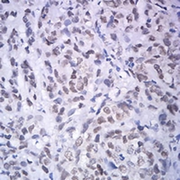 ATF4 Mouse Monoclonal Antibody