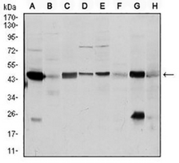 ASS1 Mouse Monoclonal Antibody