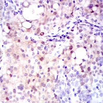 ASS1 Mouse Monoclonal Antibody
