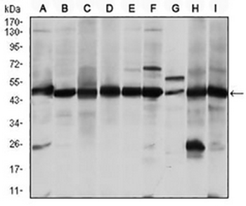 ASS1 Mouse Monoclonal Antibody