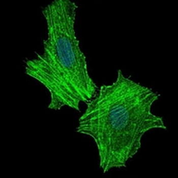 ASS1 Mouse Monoclonal Antibody